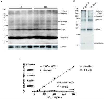 Correlations of erythrocytic oligomer α-synuclein levels with age, sex and clinical variables in patients with Parkinson’s disease